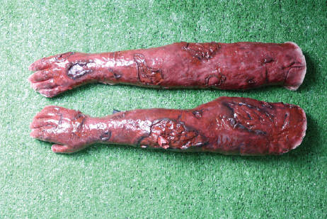 佩戴式創(chuàng  )傷四肢模擬組件