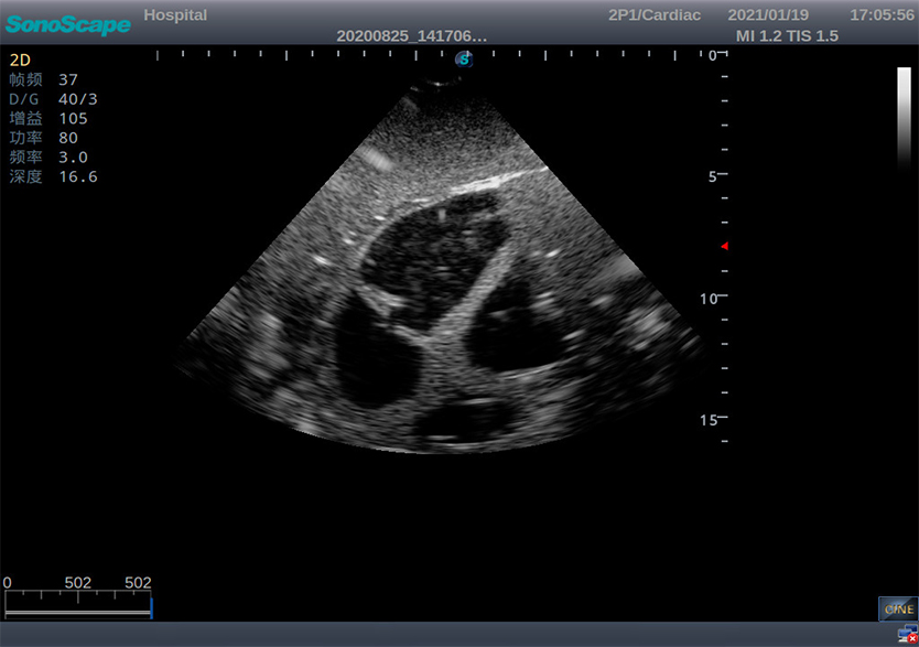 創(chuàng  )傷超聲重點(diǎn)評估平臺2.0