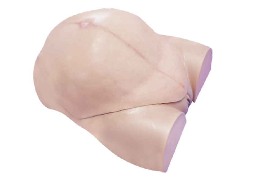 剖宮產(chǎn)手術(shù)平臺2.0